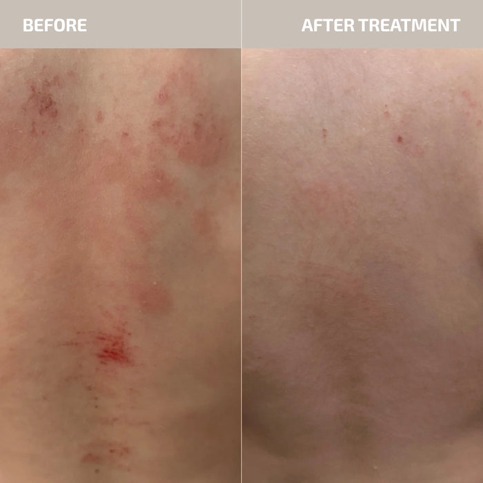 ANTU Skin Barrier Support Supplement