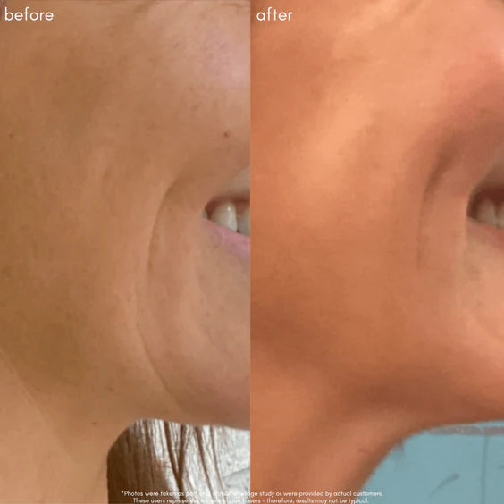 The Advanced Response Complex