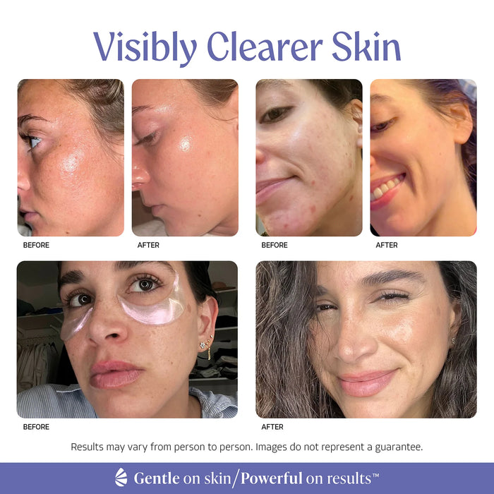 2-in-1 Hydrating Gel