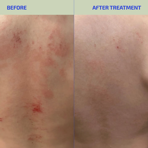 BIA ClearSkin Synbiotic Supplement