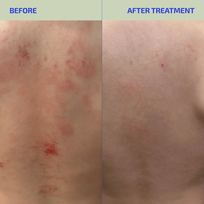 BIA ClearSkin Synbiotic Supplement