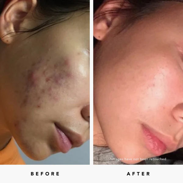 BLUE TANSY Invisible Pores Resurfacing Clarity Mask