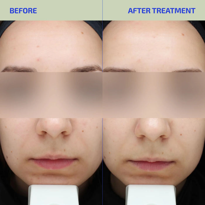 BIA Exfoliating Wash 2.0