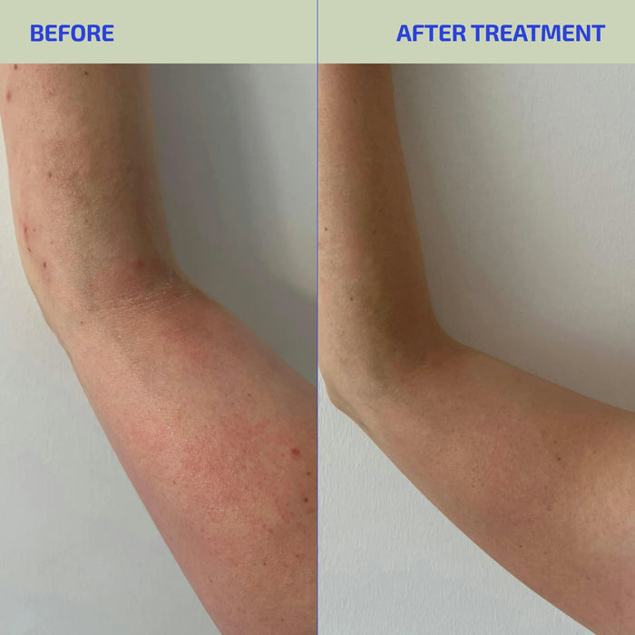 BIA Sensitive Skin Soothing Salt Wrap