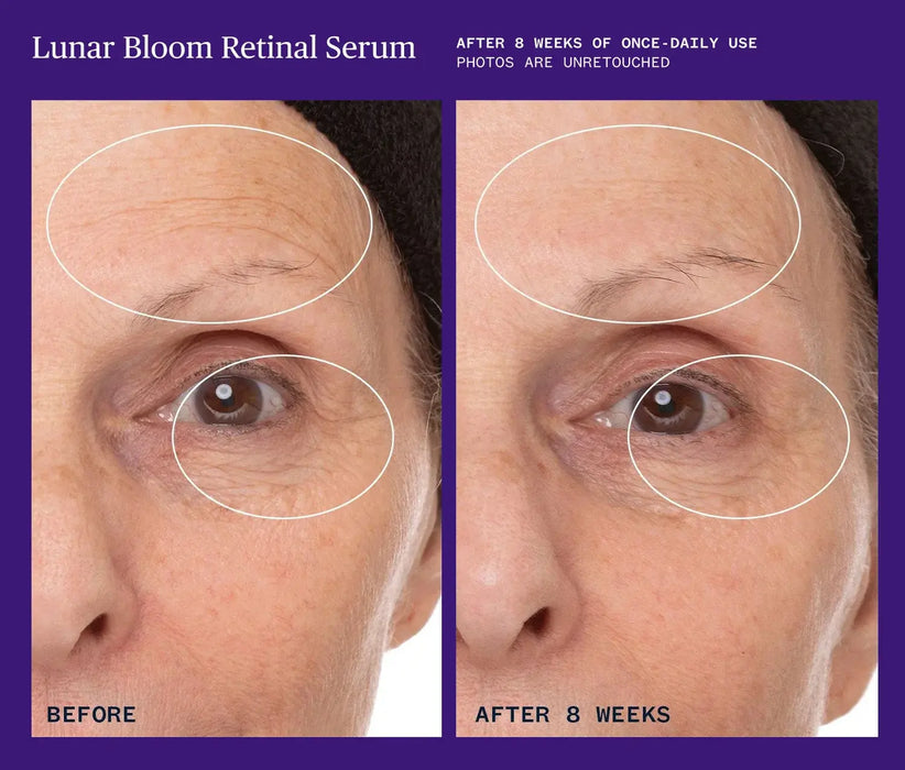 Lunar Bloom Retinal Serum