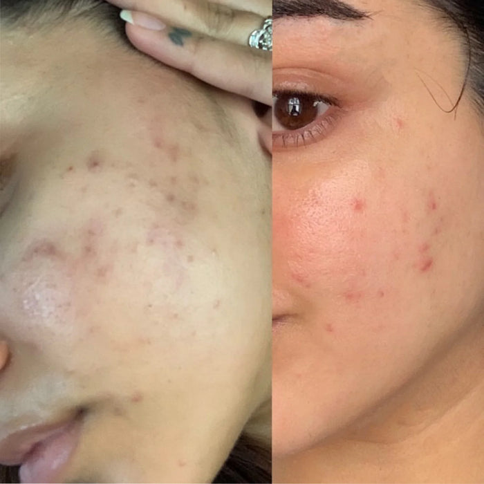 Sea Vitamin C Serum