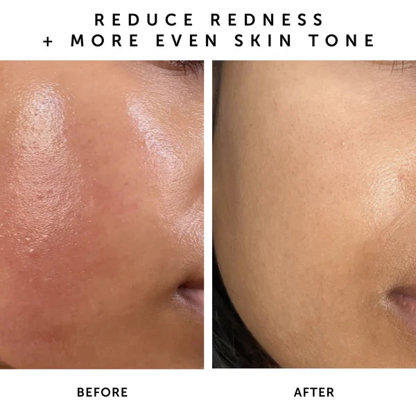 NOVA 15% Vitamin C + Turmeric Brightening Serum