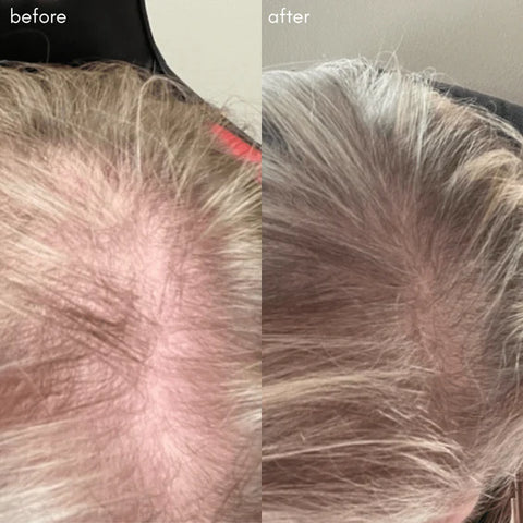 Power Fol, Advanced Multi-Correctional Lightweight Scalp and Hair Treatment