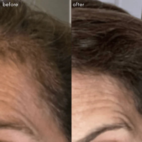 Power Fol, Advanced Multi-Correctional Lightweight Scalp and Hair Treatment