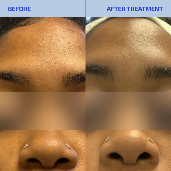 SHAANT Balancing Clay Mask