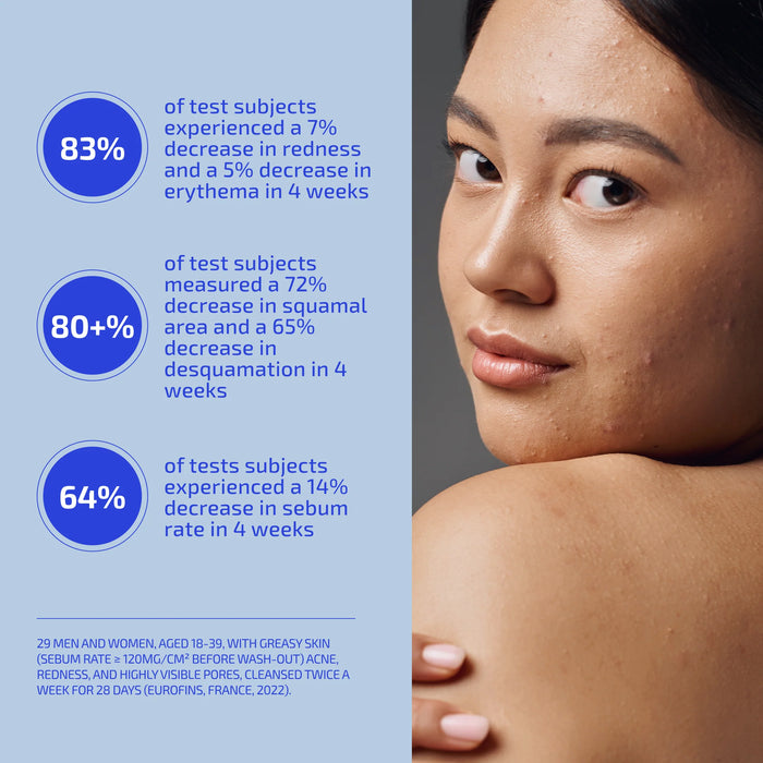 SHAANT Balancing Clay Mask