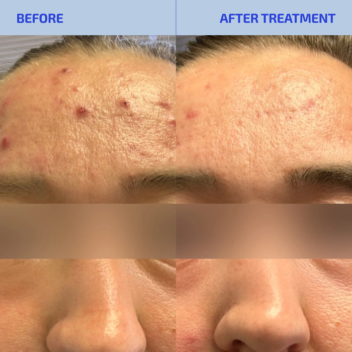 SHAANT Pore Purifying Face Scrub