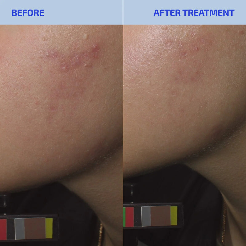 SHAANT Balancing Refining Toner