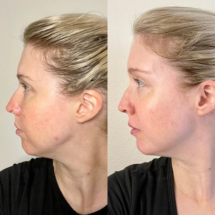 Sea Vitamin C Serum
