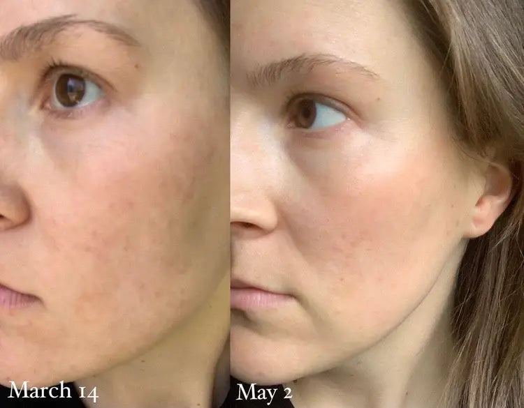 Sunnyside C Glow Serum