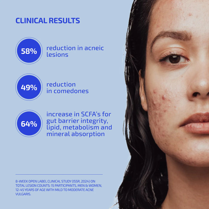 SHAANT ClearSkin Probiotic Supplement 2.0