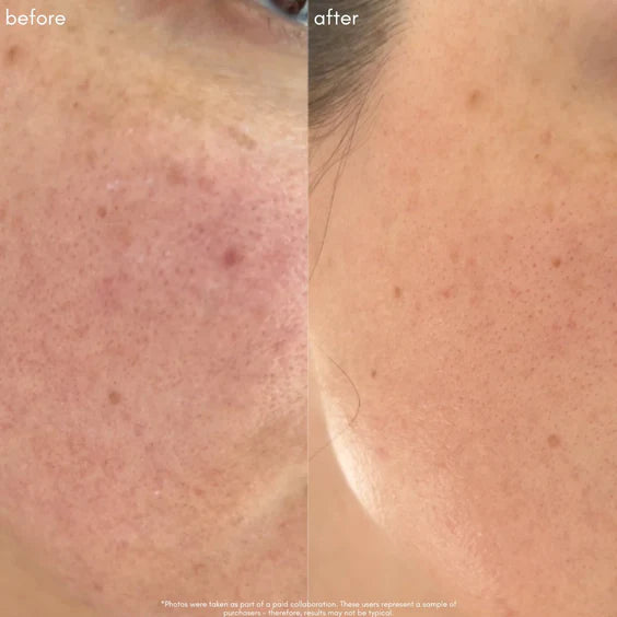 The Super lift Vitamin C-MORE Treatment