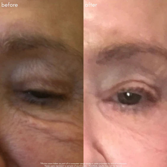 The Super lift Vitamin C-MORE Treatment