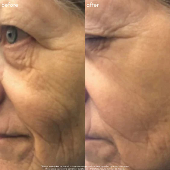 The Super lift Vitamin C-MORE Treatment