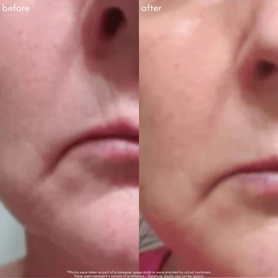 The Super lift Vitamin C-MORE Treatment