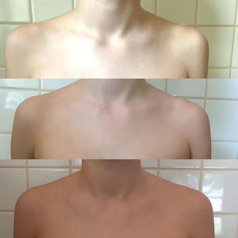 Winter skin